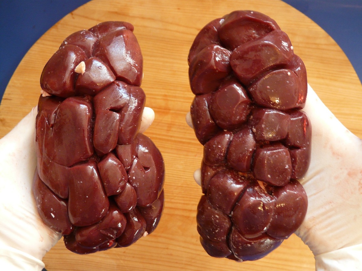 Pork kidneys for humans would be an excellent alternative for patients in the future.