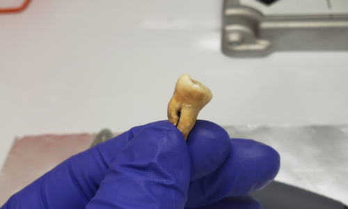 The analysis of the teeth was key.