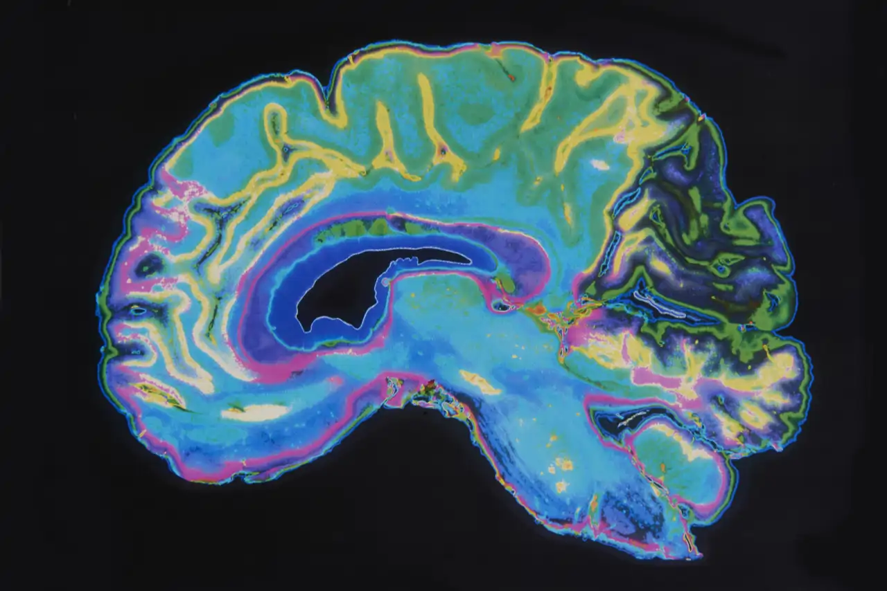 The brain's reaction to danger is explained by science.