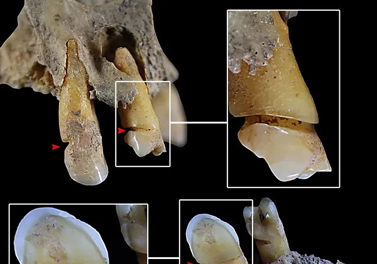The marks on the teeth show repetitive work.